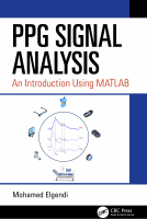 PPG Signal Analysis.pdf